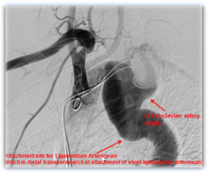 carotid-cerebral-angiography-page